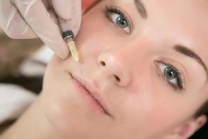 Mesotherapy is simple photo Mesotherapy is simple image